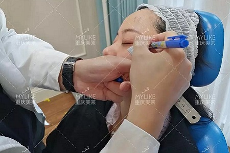 *雕
