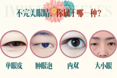 鄭州美萊整形雙眼皮多少錢？