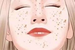 鄭州美萊超皮秒祛斑好嗎？