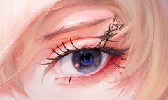 內(nèi)眼角手術(shù)風(fēng)險(xiǎn)大嗎，開眼角需要多少錢