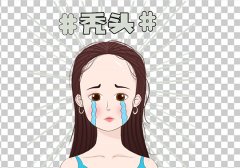 廈門做發(fā)際線種植多久長(zhǎng)出來(lái)，多久可以洗頭